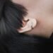 keloid vs piercing bump