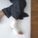 toenail removal healing stages pictures